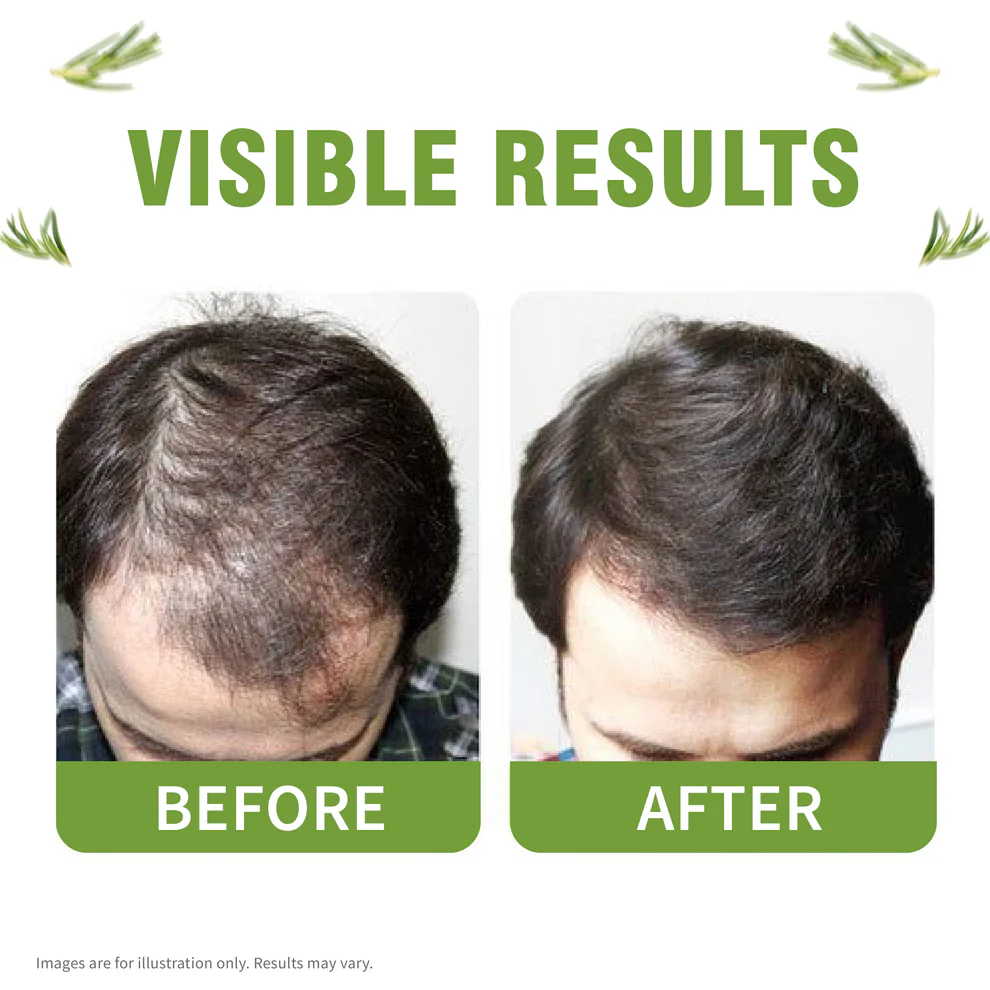 Advance Hair Vitals