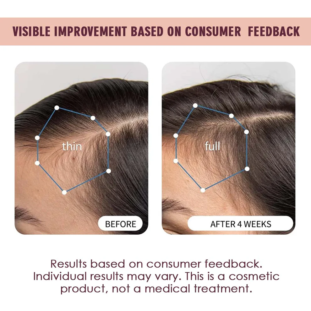 Hair Growth Serum