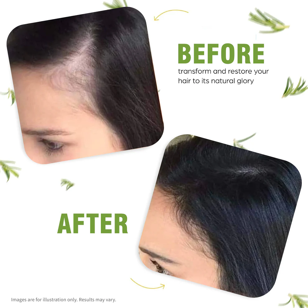 Advance Hair Kit