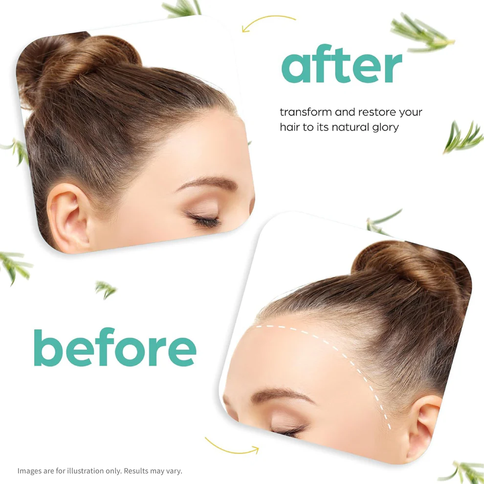 Hair Growth Oil